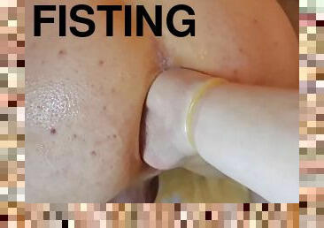 ekstrem, fisting, anal, teenager, bøsse, fødder, synsvinkel, knepning-fucking, fetish, twink