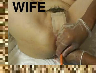 Elmers wife anal fisting speculum 4