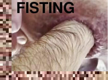 extrême, fisting, anal, hardcore, gay, bite