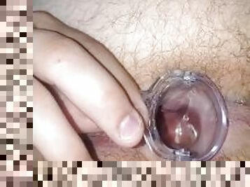 Anal gape with tools. Obgyn speculum inspection.