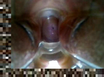 Inside Pussy View-Speculum Orgasm