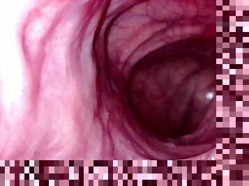 POV - Take a peek around the corner of my transverse colon